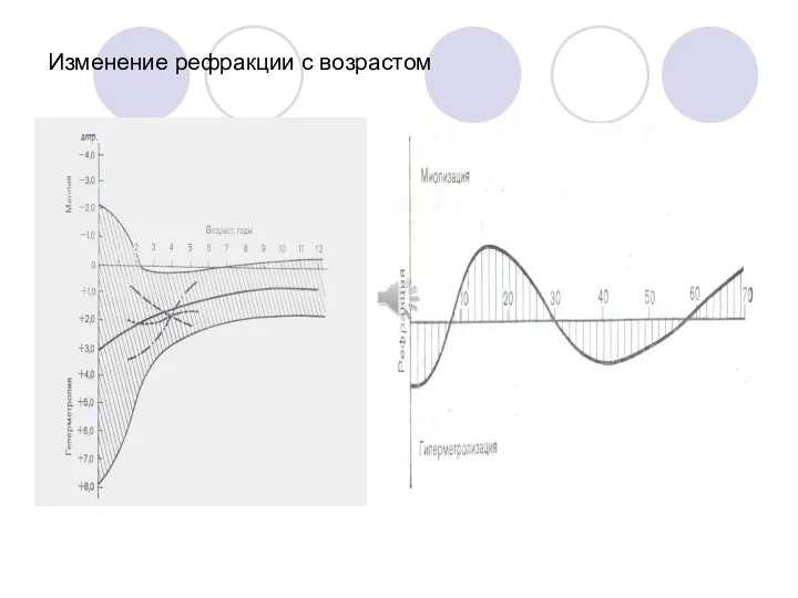 Изменение рефракции с возрастом