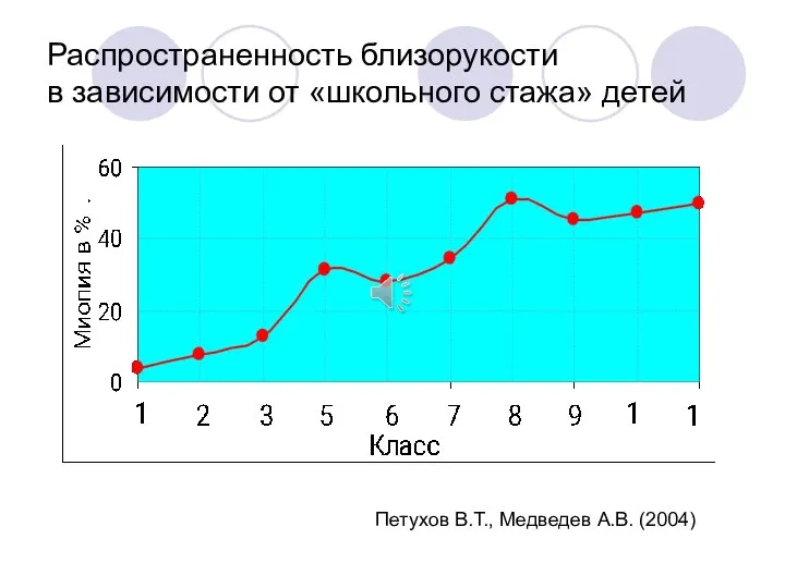 Распространенность близорукости в зависимости от «школьного стажа» детей Петухов В.Т., Медведев А.В. (2004)