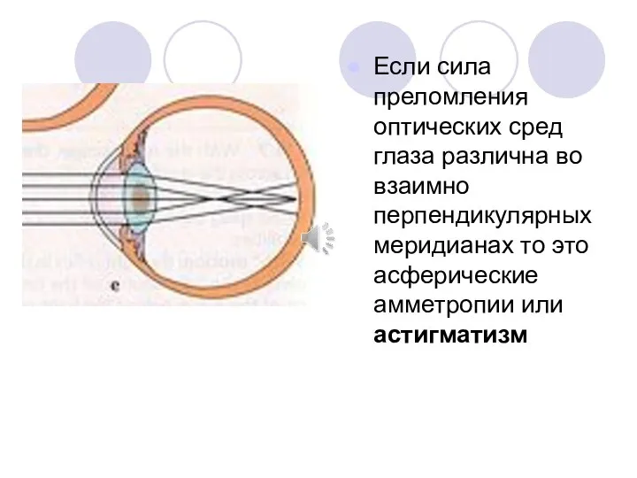 Если сила преломления оптических сред глаза различна во взаимно перпендикулярных меридианах