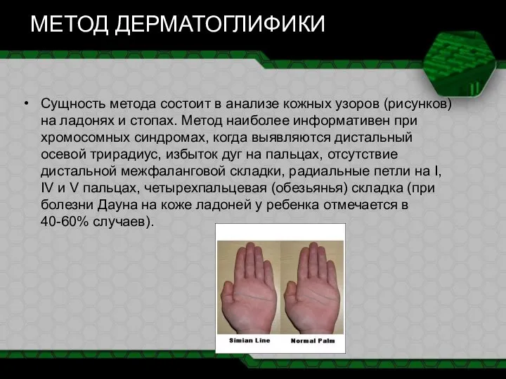 МЕТОД ДЕРМАТОГЛИФИКИ Сущность метода состоит в анализе кожных узоров (рисунков) на