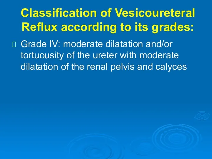 Classification of Vesicoureteral Reflux according to its grades: Grade IV: moderate