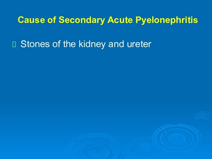 Cause of Secondary Acute Pyelonephritis Stones of the kidney and ureter