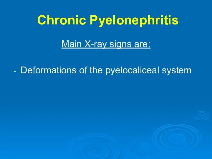 Chronic Pyelonephritis Main X-ray signs are: Deformations of the pyelocaliceal system