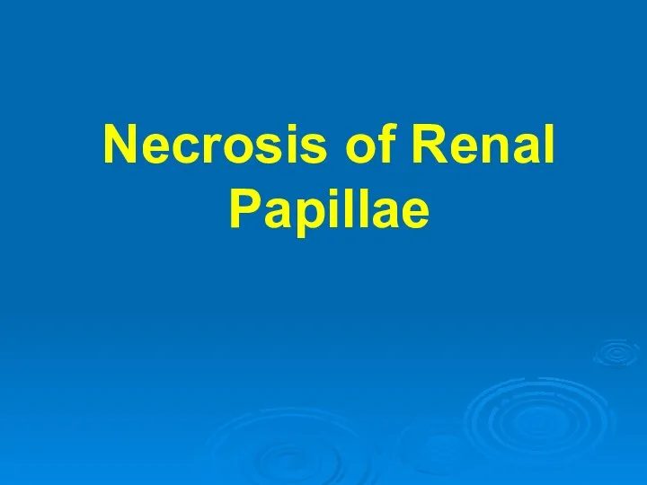 Necrosis of Renal Papillae