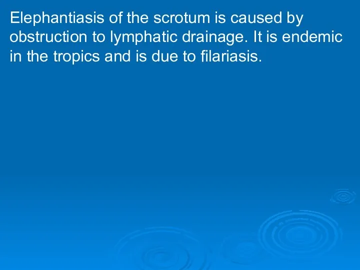 Elephantiasis of the scrotum is caused by obstruction to lymphatic drainage.