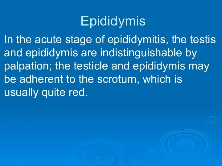 Epididymis In the acute stage of epididymitis, the testis and epididymis