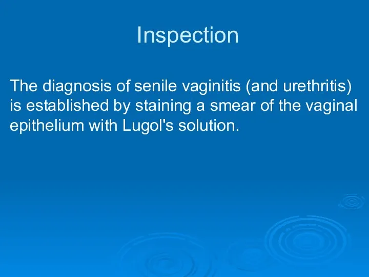 Inspection The diagnosis of senile vaginitis (and urethritis) is established by