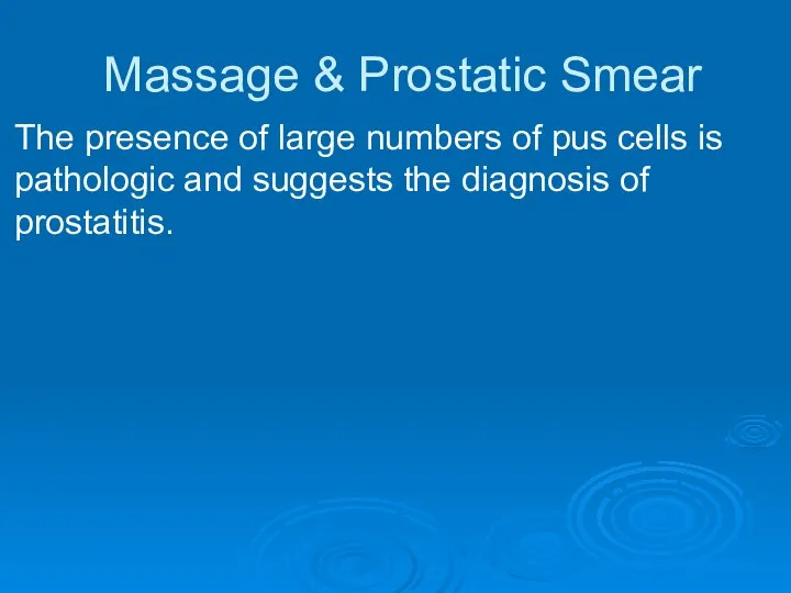 Massage & Prostatic Smear The presence of large numbers of pus