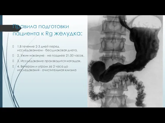 Правила подготовки пациента к Rg желудка: 1.В течение 2-3 дней перед