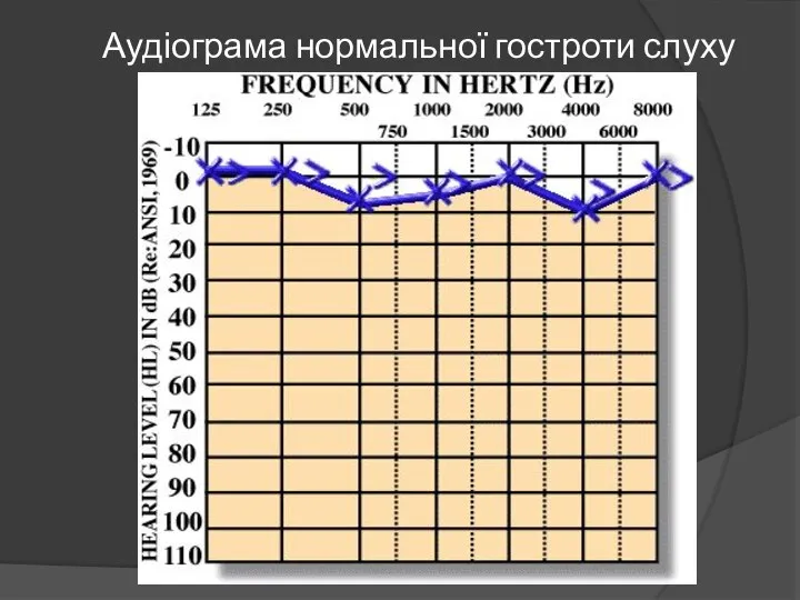 Аудіограма нормальної гостроти слуху