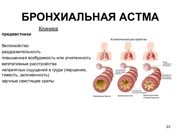 БРОНХИАЛЬНАЯ ACTМA Клиника предвестники беспокойство раздражительность повышенная возбудимость или угнетенность вегетативные