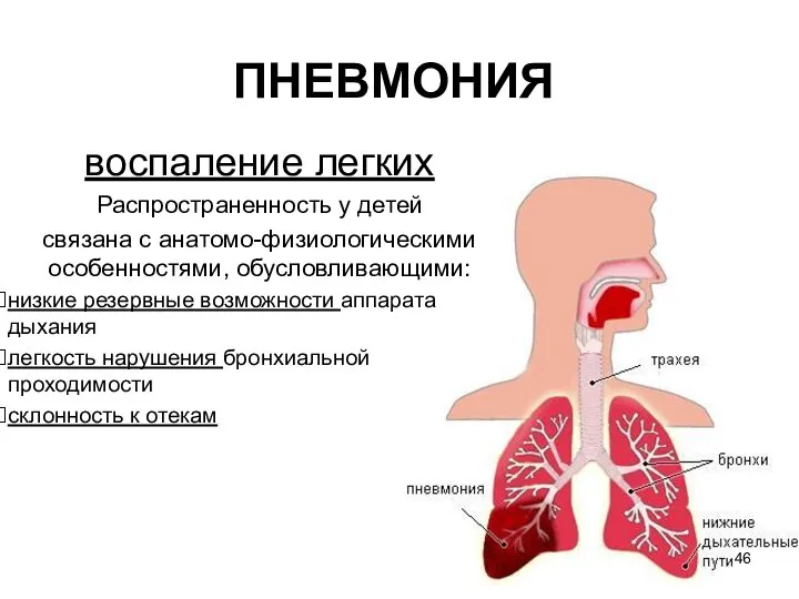 ПНЕВМОНИЯ воспаление легких Распространенность у детей связана с анатомо-физиологическими особенностями, обусловливающими: