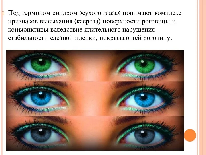 Под термином синдром «сухого глаза» понимают комплекс признаков высыхания (ксероза) поверхности