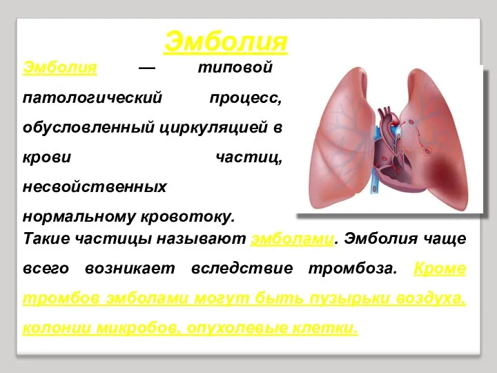 Эмболия — типовой патологический процесс, обусловленный циркуляцией в крови частиц, несвойственных