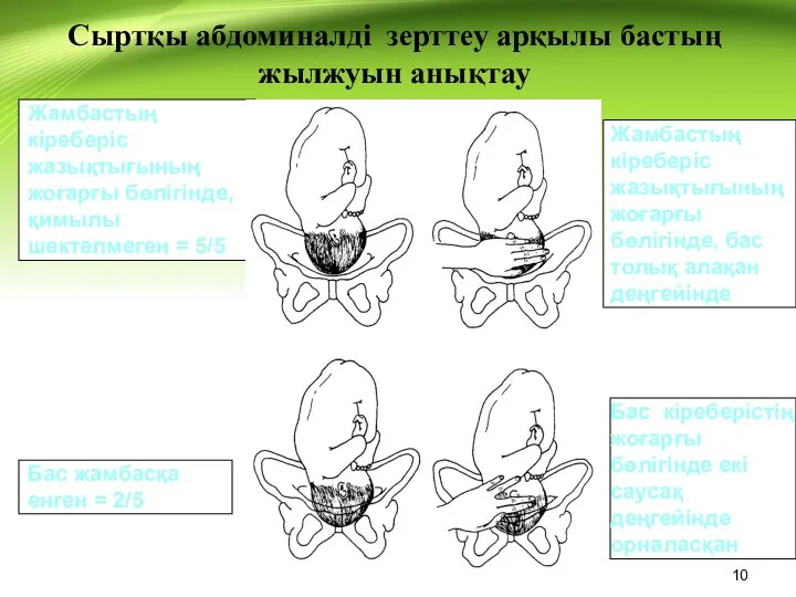 Жамбастың кіреберіс жазықтығының жоғарғы бөлігінде, қимылы шектелмеген = 5/5 Жамбастың кіреберіс