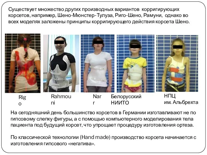 Существует множество других производных вариантов корригирующих корсетов, например, Шено-Мюнстер-Тулуза, Риго-Шено, Рамуни,