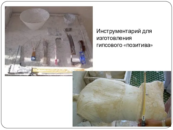 Инструментарий для изготовления гипсового «позитива»