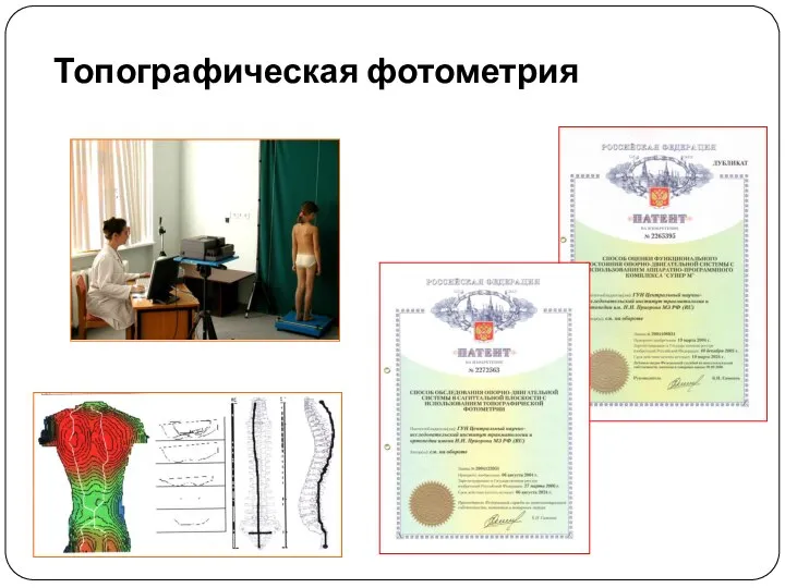 Топографическая фотометрия