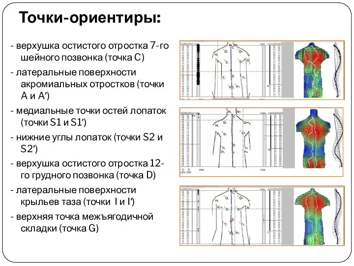 Точки-ориентиры: - верхушка остистого отростка 7-го шейного позвонка (точка C) -