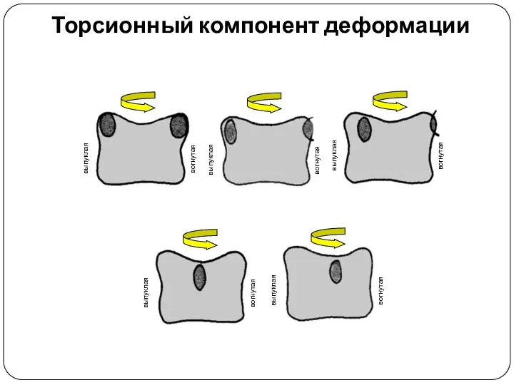 Торсионный компонент деформации