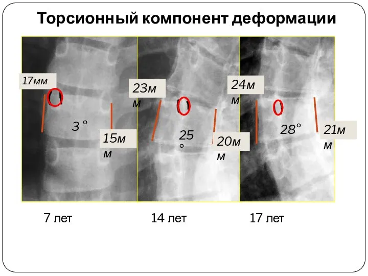 3 ° 25 ° 28° 17мм 23мм 24мм 15мм 20мм 21мм