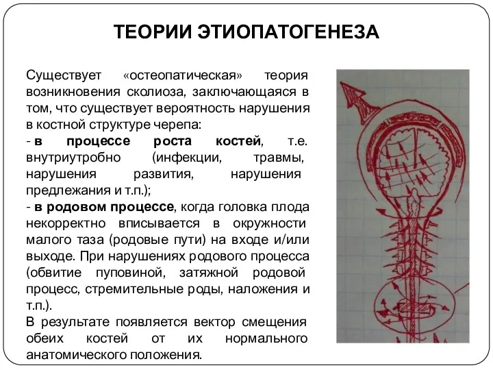 ТЕОРИИ ЭТИОПАТОГЕНЕЗА Существует «остеопатическая» теория возникновения сколиоза, заключающаяся в том, что