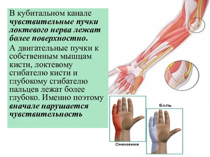 В кубитальном канале чувствительные пучки локтевого нерва лежат более поверхностно. А