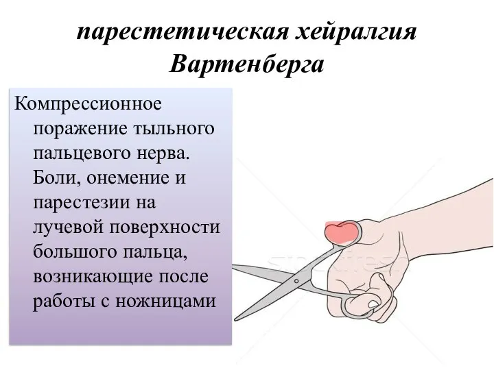 парестетическая хейралгия Вартенберга Компрессионное поражение тыльного пальцевого нерва. Боли, онемение и