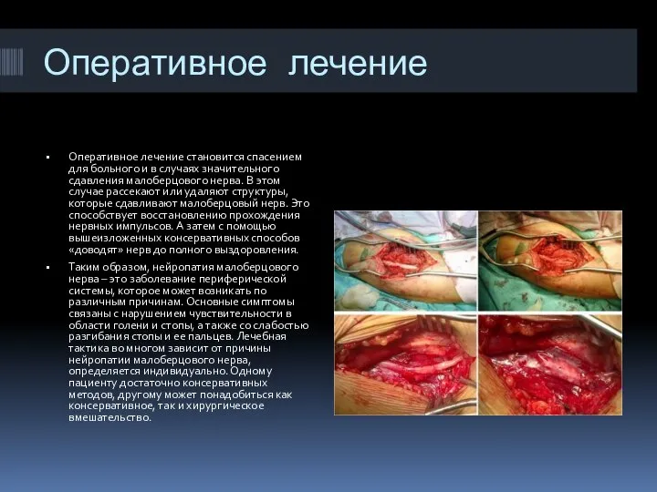 Оперативное лечение Оперативное лечение становится спасением для больного и в случаях