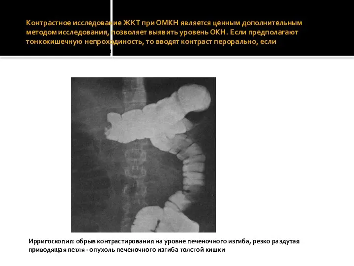 Контрастное исследование ЖКТ при ОМКН является ценным дополнительным методом исследования, позволяет