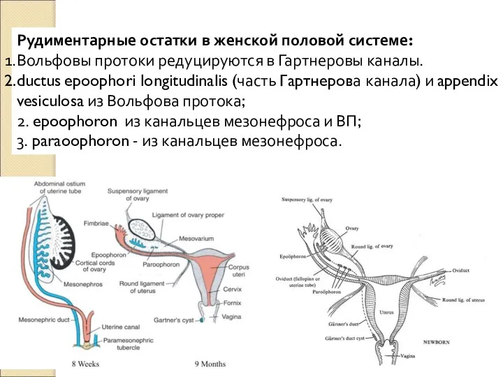 Рудиментарные остатки в женской половой системе: Вольфовы протоки редуцируются в Гартнеровы