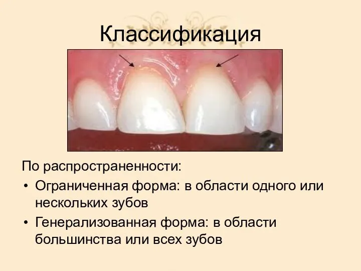 Классификация По распространенности: Ограниченная форма: в области одного или нескольких зубов