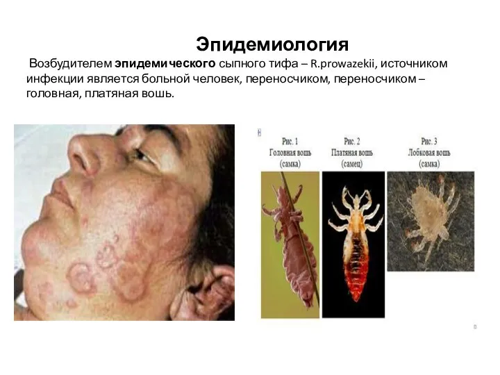 Эпидемиология Возбудителем эпидемического сыпного тифа – R.prowazekii, источником инфекции является больной