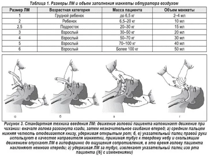 Ларингеальная маска