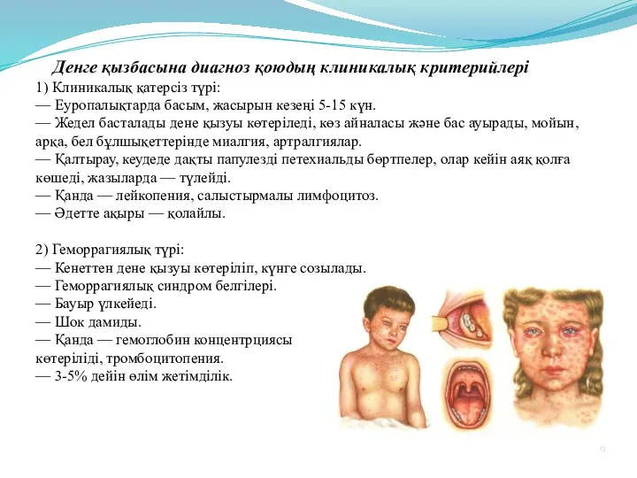 Денге қызбасына диагноз қоюдың клиникалық критерийлері 1) Клиникалық қатерсіз түрі: —