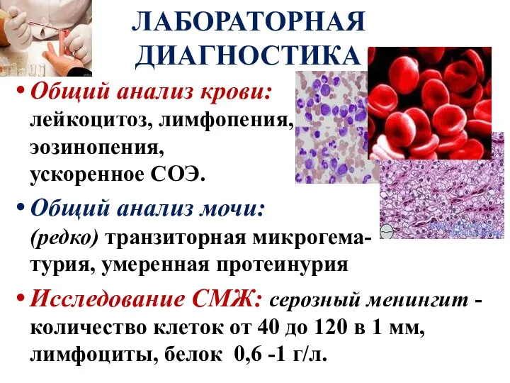 Общий анализ крови: лейкоцитоз, лимфопения, эозинопения, ускоренное СОЭ. Общий анализ мочи: