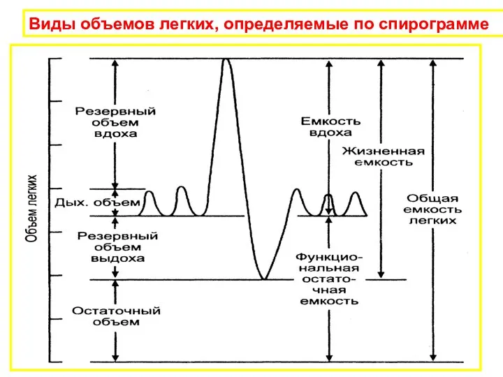 Виды объемов легких, определяемые по спирограмме