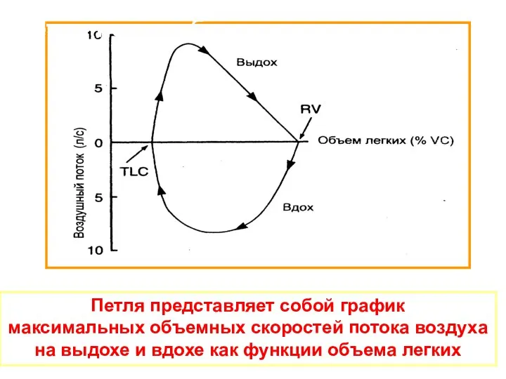 Петля поток-объем Петля представляет собой график максимальных объемных скоростей потока воздуха