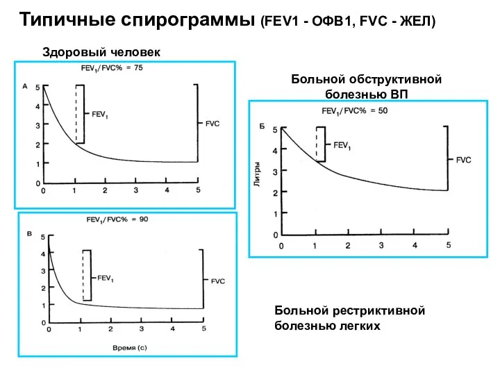 Типичные спирограммы (FEV1 - ОФВ1, FVC - ЖЕЛ) Здоровый человек Больной