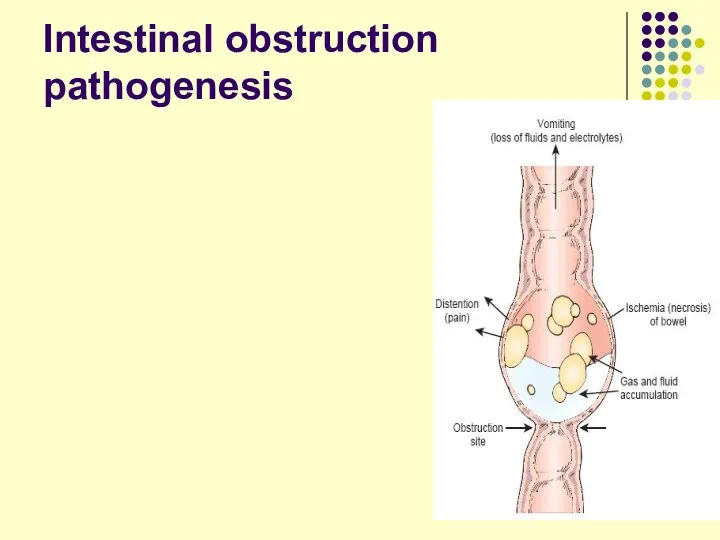 Intestinal obstruction pathogenesis