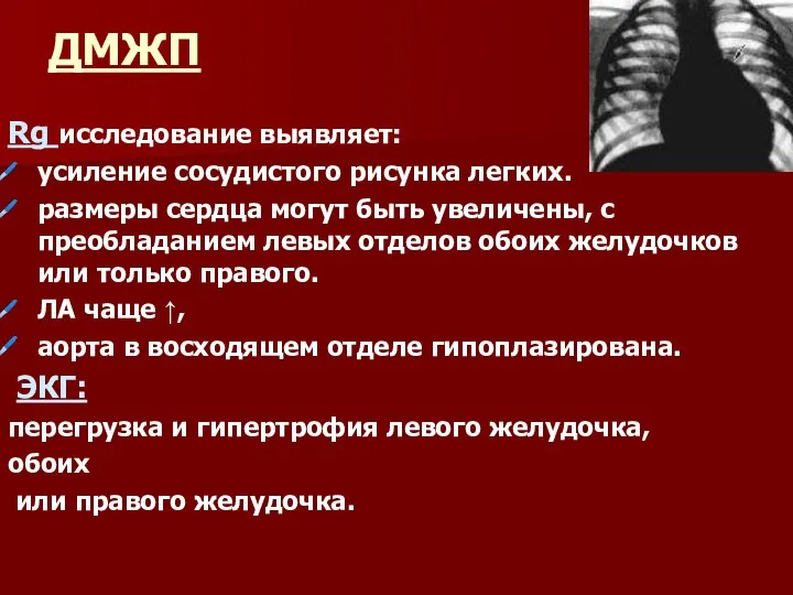 ДМЖП Rg исследование выявляет: усиление сосудистого рисунка легких. размеры сердца могут