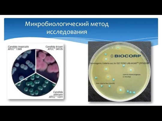 Микробиологический метод исследования