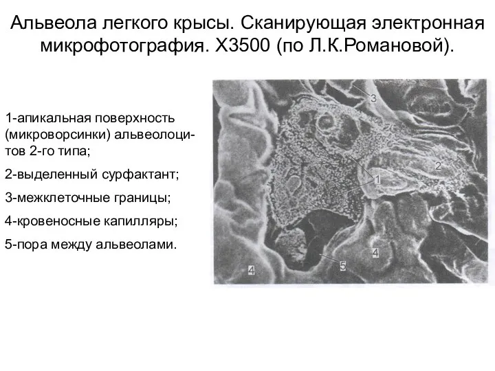 Альвеола легкого крысы. Сканирующая электронная микрофотография. Х3500 (по Л.К.Романовой). 1-апикальная поверхность