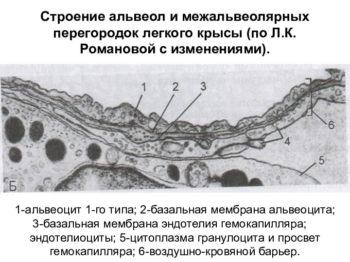 Строение альвеол и межальвеолярных перегородок легкого крысы (по Л.К.Романовой с изменениями).