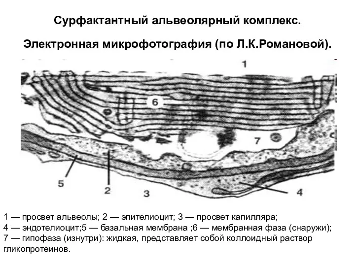 Сурфактантный альвеолярный комплекс. Электронная микрофотография (по Л.К.Романовой). 1 — просвет альвеолы;