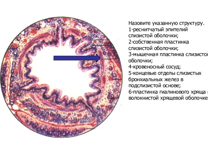 Назовите указанную структуру. 1-реснитчатый эпителий слизистой оболочки; 2-собственная пластинка слизистой оболочки;