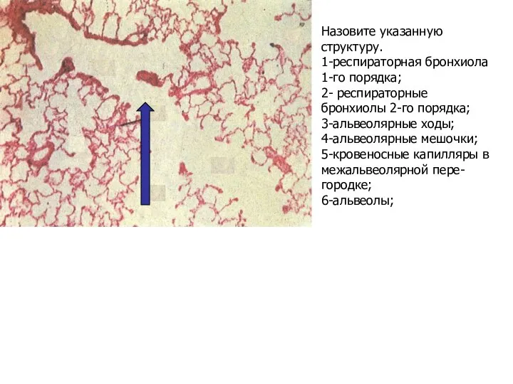 Назовите указанную структуру. 1-респираторная бронхиола 1-го порядка; 2- респираторные бронхиолы 2-го