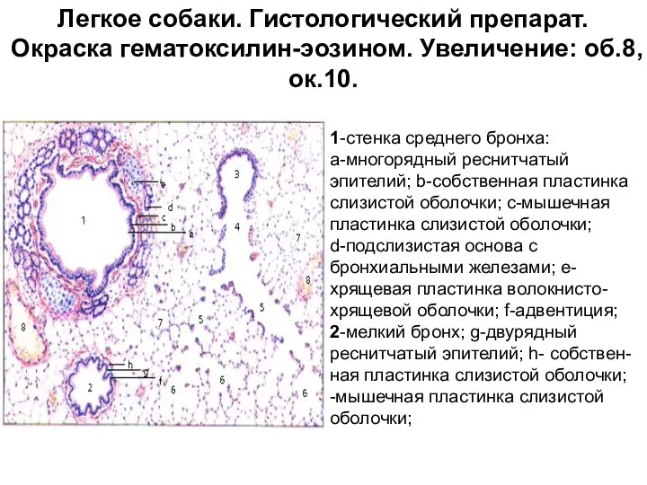 Легкое собаки. Гистологический препарат. Окраска гематоксилин-эозином. Увеличение: об.8, ок.10. 1-стенка среднего