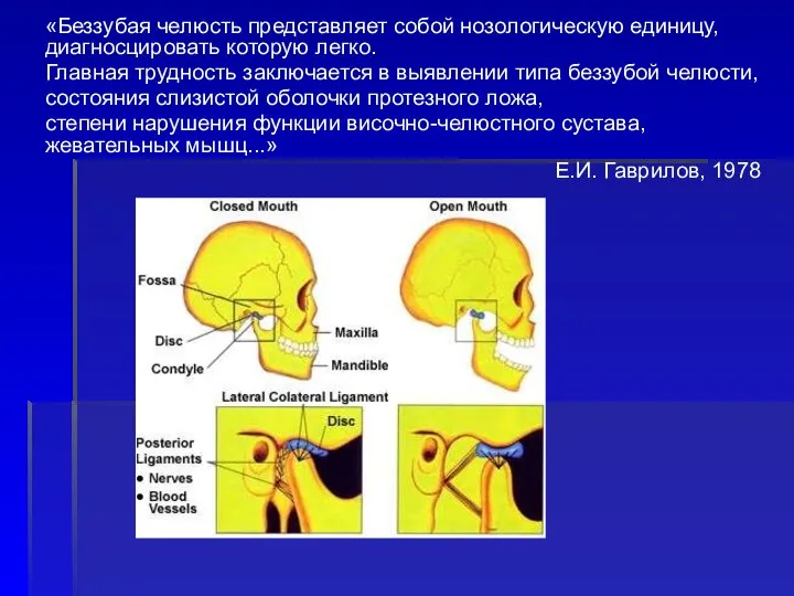 «Беззубая челюсть представляет собой нозологическую единицу, диагносцировать которую легко. Главная трудность