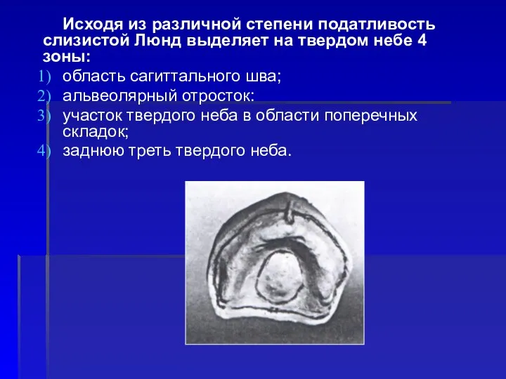 Исходя из различной степени податливость слизистой Люнд выделяет на твердом небе